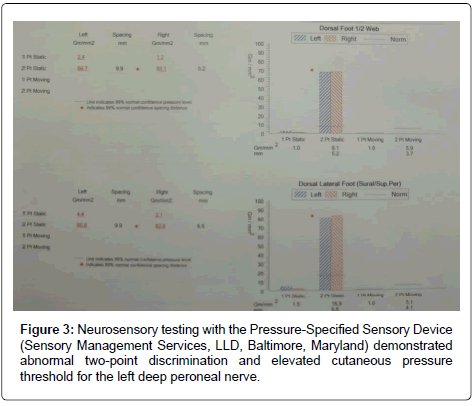 clinical-foot-ankle-Neurosensory