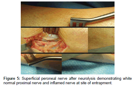 clinical-foot-ankle-proximal-nerve