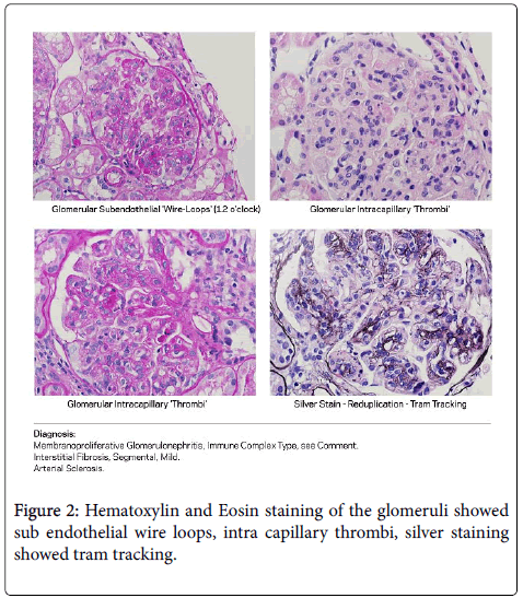 clinical-infectious-diseases-practice-Eosin-staining