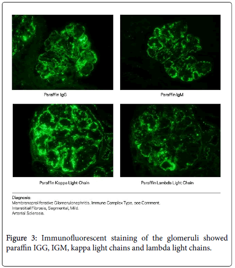 clinical-infectious-diseases-practice-Immunofluorescent