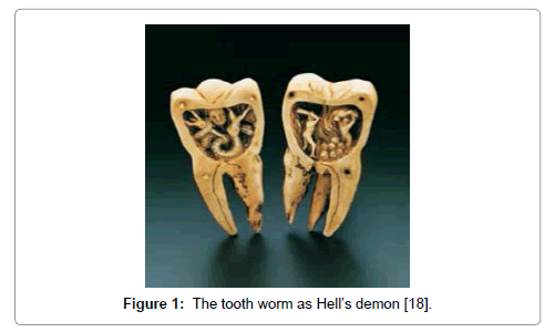 clinical-infectious-diseases-practice-tooth-worm
