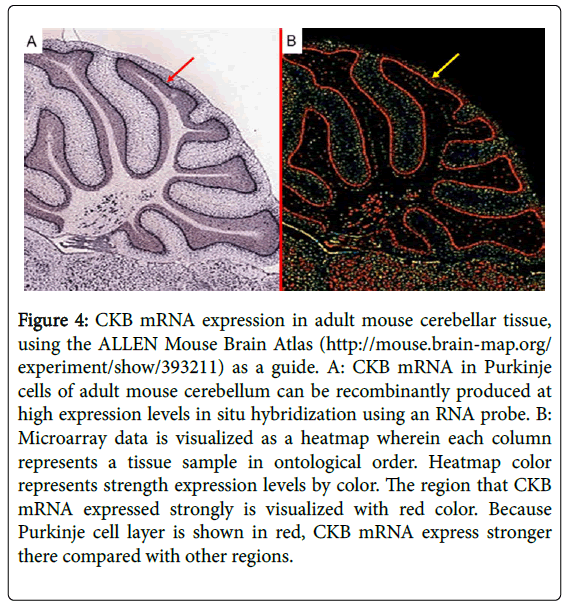 clinical-neuroimmunology-mouse-cerebellar-tissue