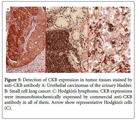 clinical-neuroimmunology-tumor-tissues-stained