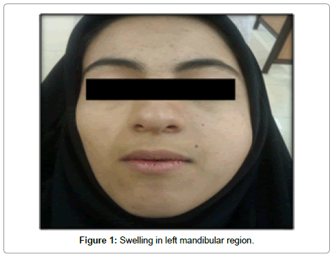 clinical-pathology-Swelling-left