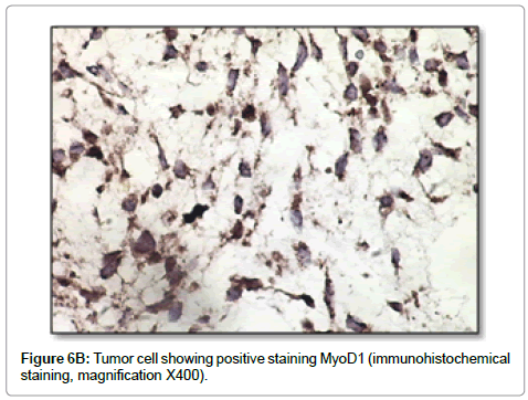 clinical-pathology-positive-staining