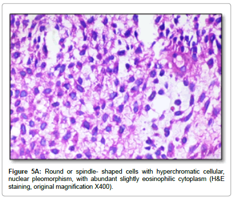 clinical-pathology-spindle-cytoplasm