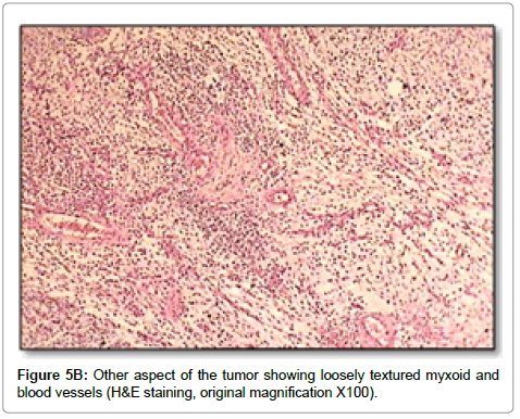 clinical-pathology-tumor-blood