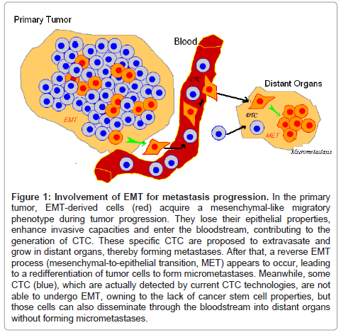 clinical-pathology-tumor-cells