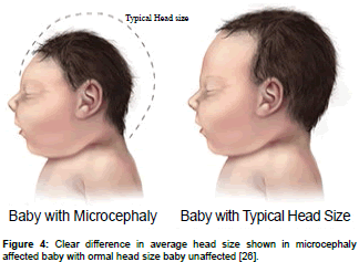 clinical-pharmacology-biopharmaceutics-ormal-head-baby