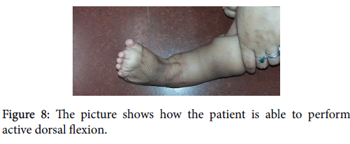clinical-research-foot-ankle-active-dorsal-flexion
