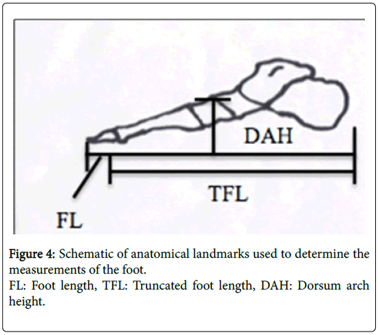 clinical-research-foot-ankle-anatomical-landmarks