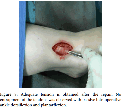 clinical-research-foot-ankle-dorsiflexion-plantarflexion