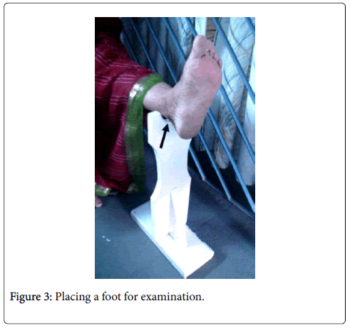 clinical-research-foot-ankle-placing-foot
