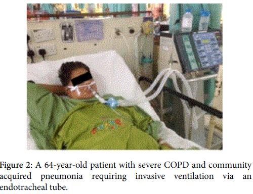 Case study copd pneumonia