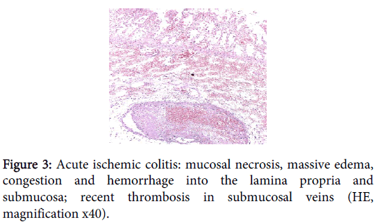 Clinical-toxicology-mucosal-necrosis