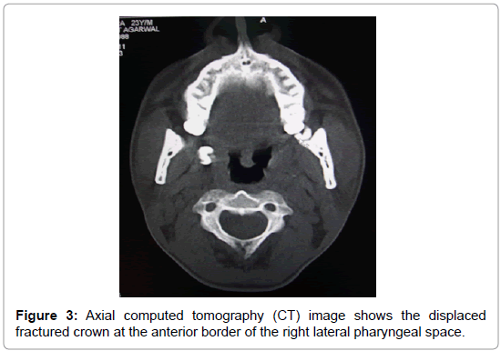 community-medicine-computed-tomography