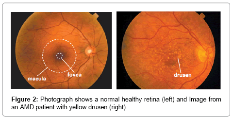 computer-science-systems-biology-healthy-retina