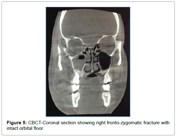 cosmetology-orofacial-surgery-CBCT-Coronal