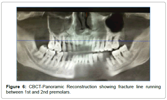 cosmetology-orofacial-surgery-CBCT-Panoramic