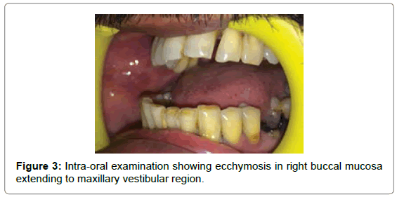 cosmetology-orofacial-surgery-Intra-oral