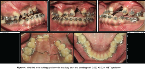 cosmetology-orofacial-surgery-Modified-arch-holding