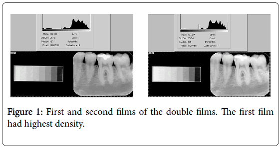 cosmetology-orofacial-surgery-double-films