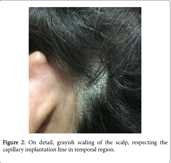 cosmetology-orofacial-surgery-grayish-scaling