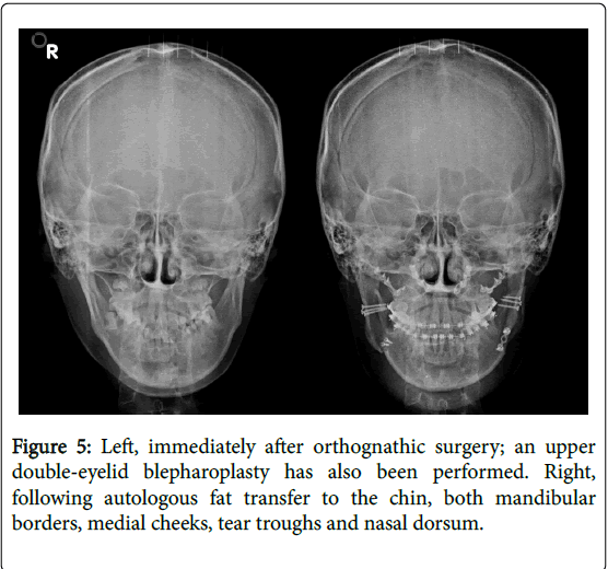 cosmetology-orofacial-surgery-orthognathic-surgery