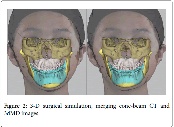 cosmetology-orofacial-surgery-surgical-simulation