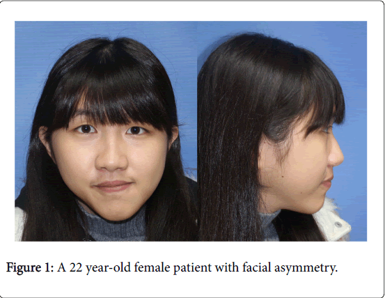 cosmetology-orofacial-surgery-year-old