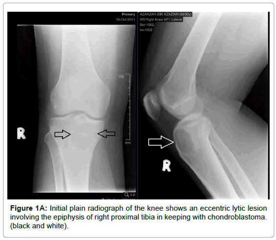 currentissue-orthopedic-oncology-plain-radiograph