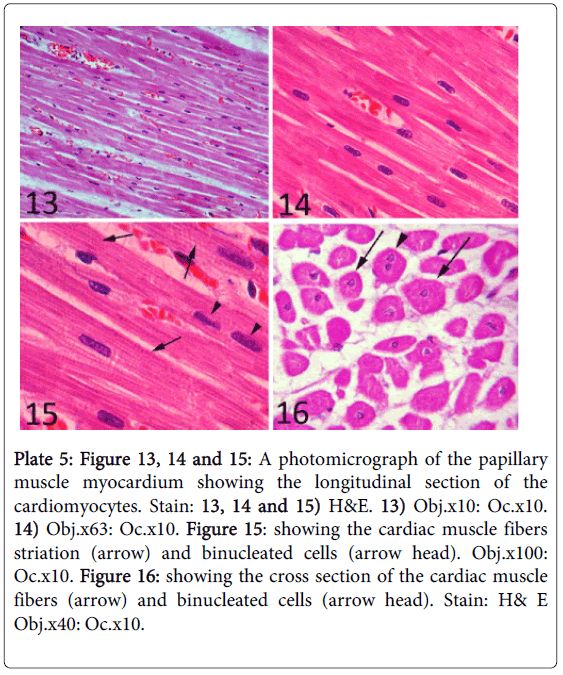 cytology-histology-a-photomicrograph-myocardium