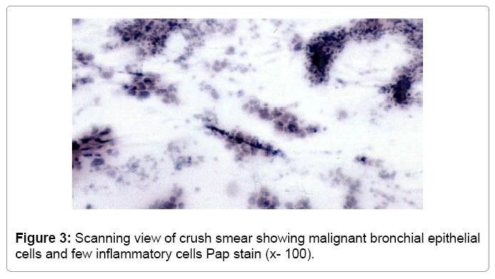 cytology-histology-crush-smear