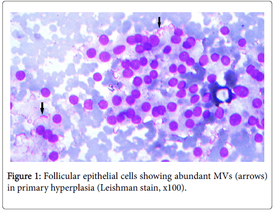 cytology-histology-follicular