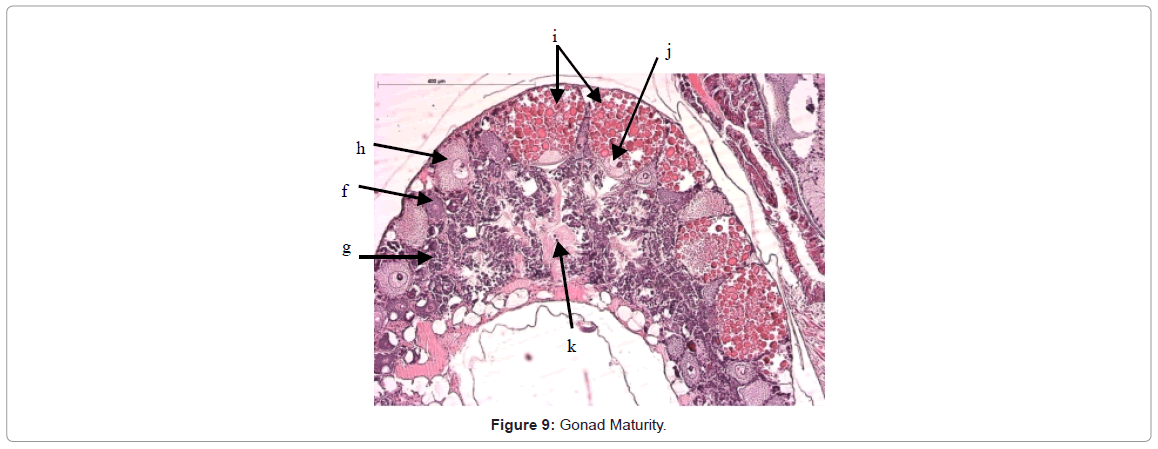 Histological Study of Gonadogenesis in Potamopyrgus 