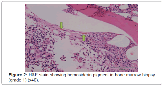 Cytology Histology He Stain Grade 1