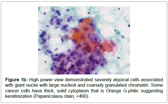 cytology-histology-high-power-view-demonstrated