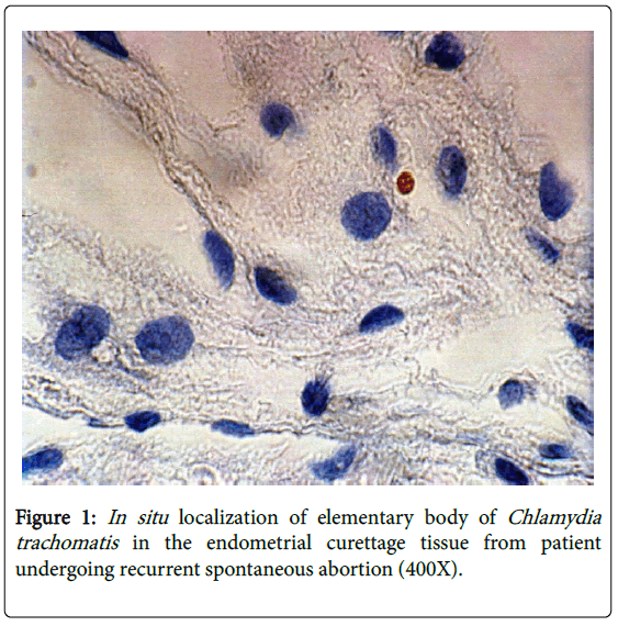 Chlamydia Histology