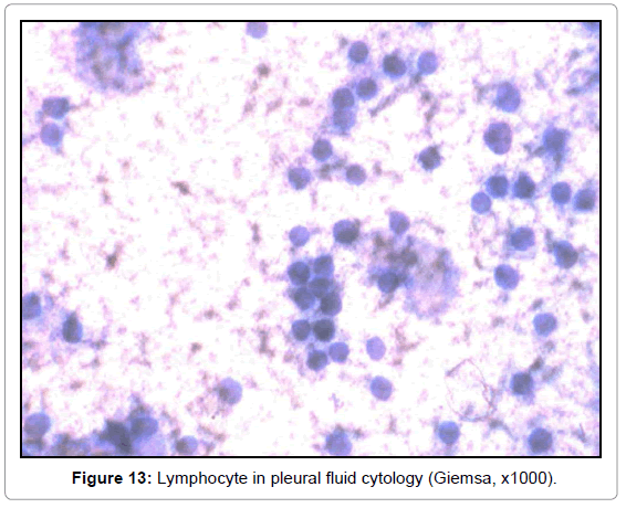 Histology Of Pleura