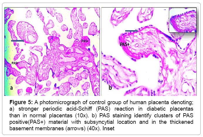 cytology histology placenta denoting 6 307 g005