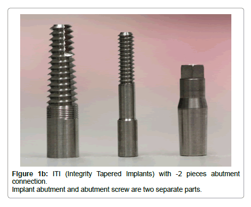 dental-implants-dentures-abutment