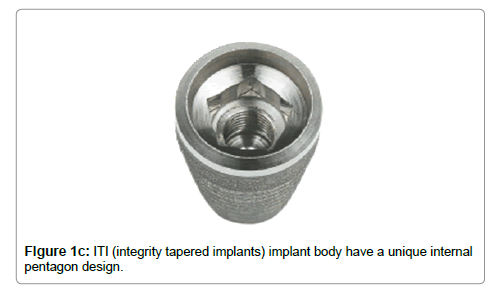 dental-implants-dentures-body