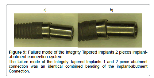 dental-implants-dentures-identical