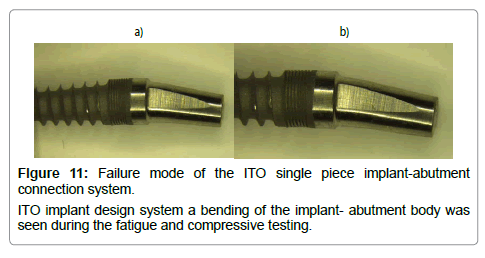 dental-implants-dentures-testing