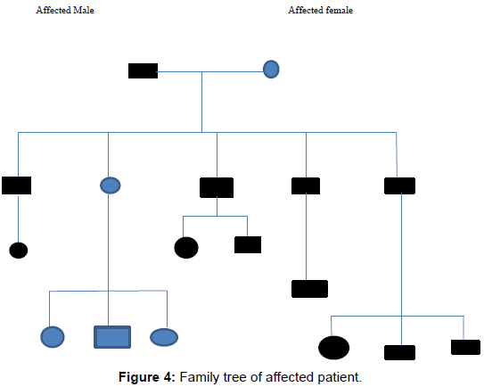 Piebaldism: A Brief Report | OMICS International