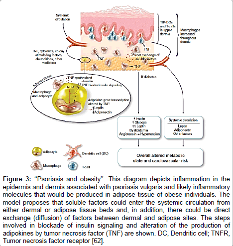 Cardiovascular And Metabolic Comorbidities Of Psoriasis | OMICS ...