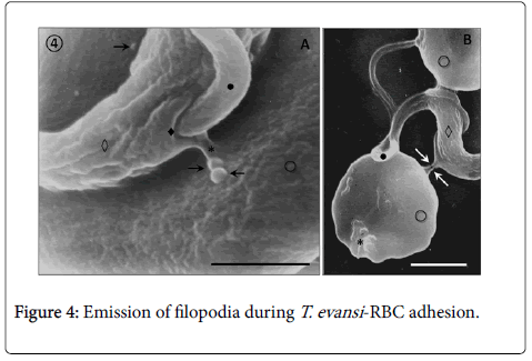 diagnostic-pathology-Emission-filopodia