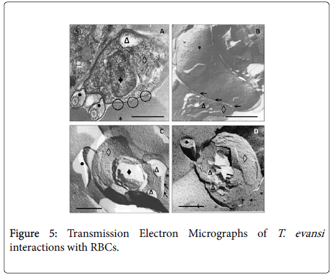 diagnostic-pathology-Transmission