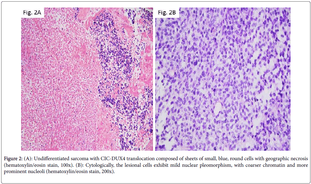 diagnostic-pathology-blue-lesional