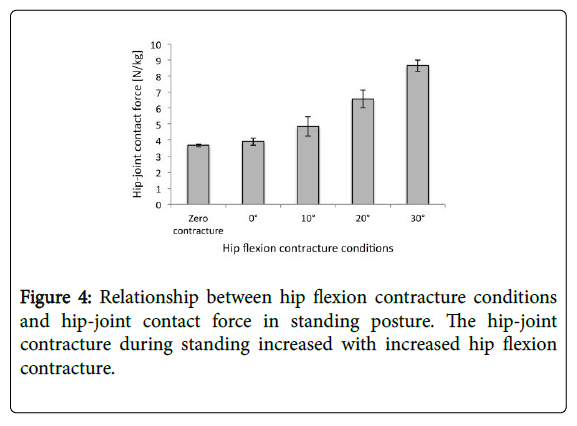 contracture-千图网